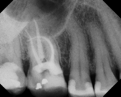Root Canal Anatomy - Stratford