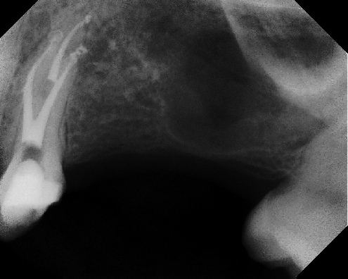 Root Canal Anatomy - Meriden