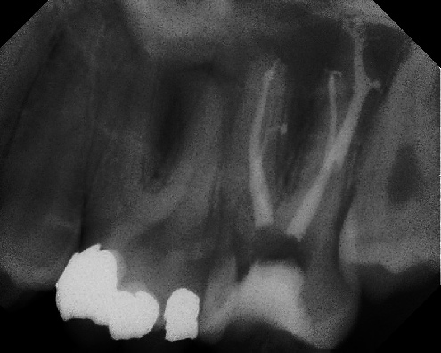 Root Canal Anatomy - Stratford