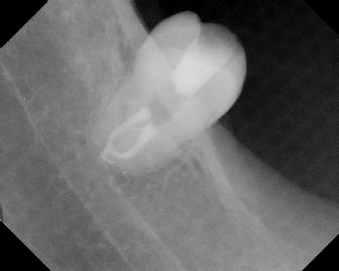 Root Canal Anatomy - Stratford